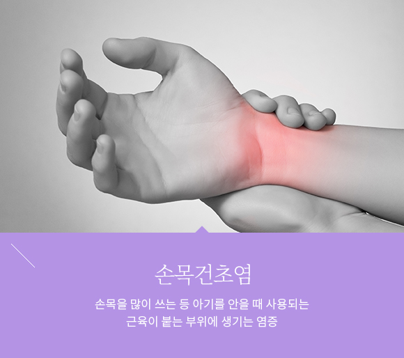 산후풍 손목 통증 치료 —손목 보호대 착용, 봉독 약침(수유중 안전), 뜸치료 방법 안내이미지