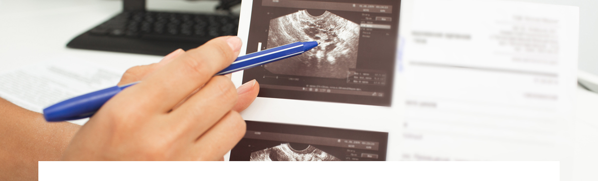 임신을 방해하는 자궁 난소질환