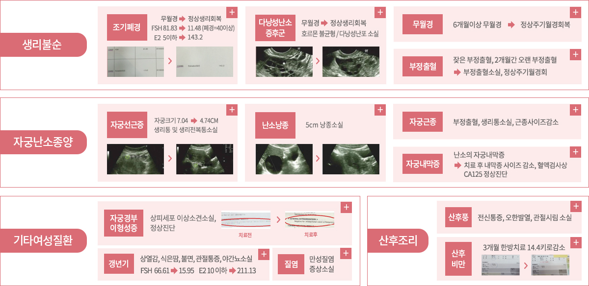 여성질환 치료사례