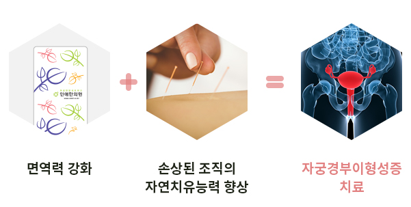 인애한의원 자궁경부이형성증 한방 근본치료— 비수술 치료로 면역력강화·바이러스 저항력·재발 방지안내