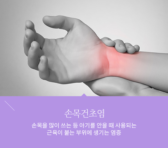 산후풍 손목 통증 치료 —손목 보호대 착용, 봉독 약침(수유중 안전), 뜸치료 방법 안내이미지